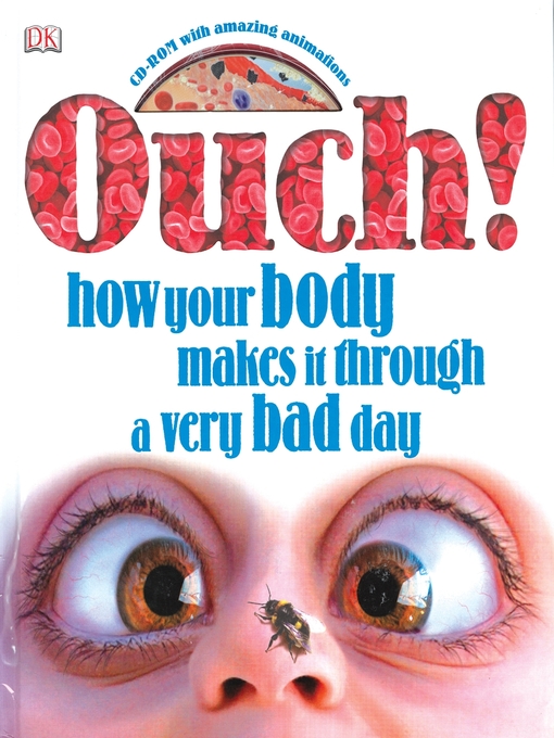 Title details for Ouch by Richard Walker - Available